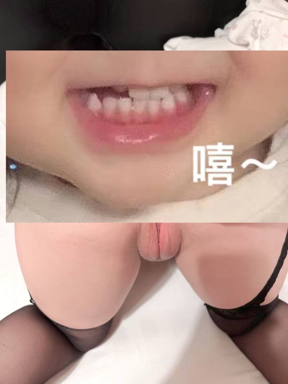 a123456095