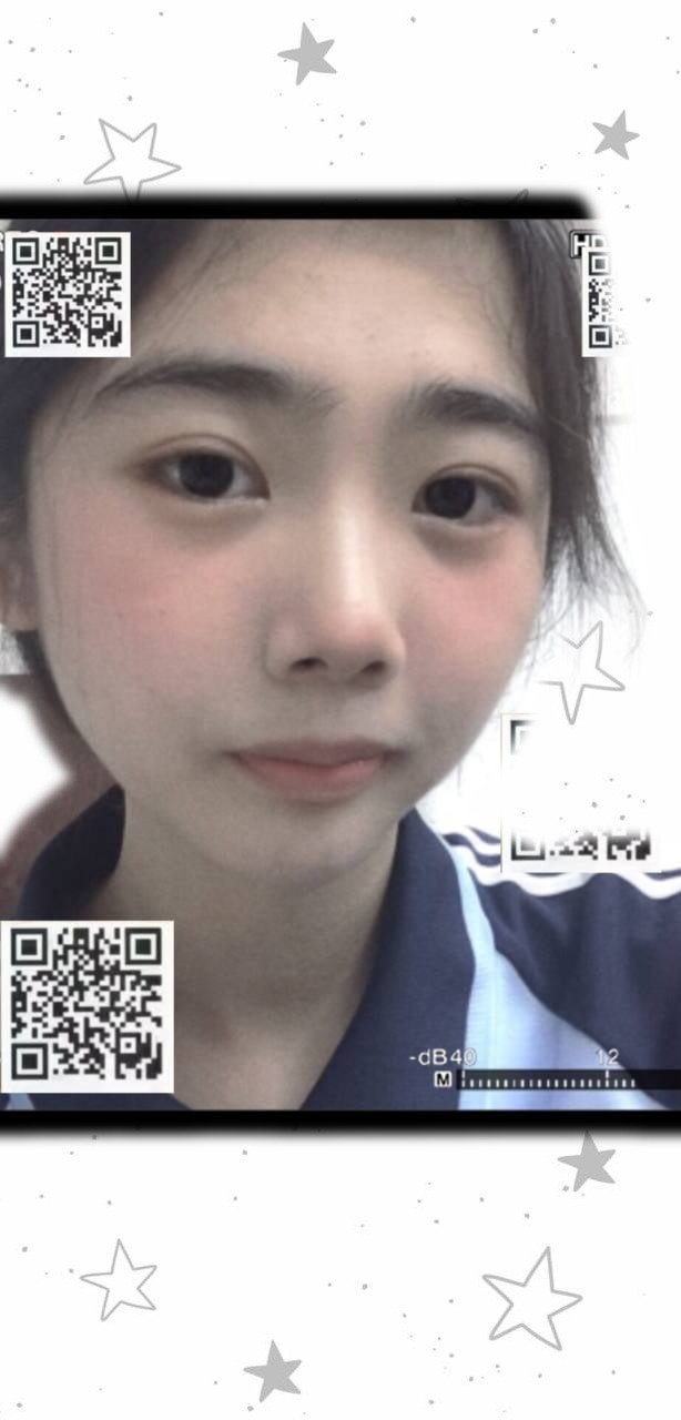 小琐
